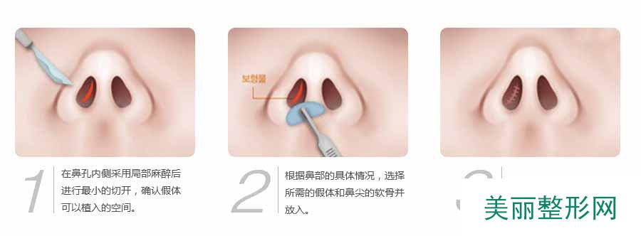 临沂瑞丽整形医院怎么样？价格表全新完整一览