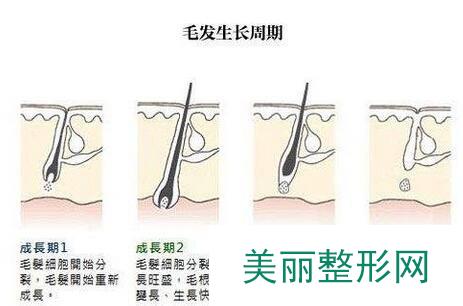 天津冰点e光脱毛价格大概多少？比北上广低吗？