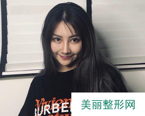 烟台鹏爱佳妍美容整形价格表详情一览，附自体脂肪填充案例果对比