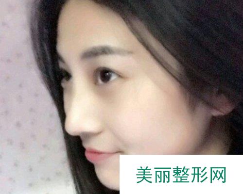 荆州华美仁爱2019全新价格表一览及案例展示