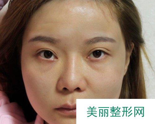 长沙雅美整形2019全新价格表一览及案例展示