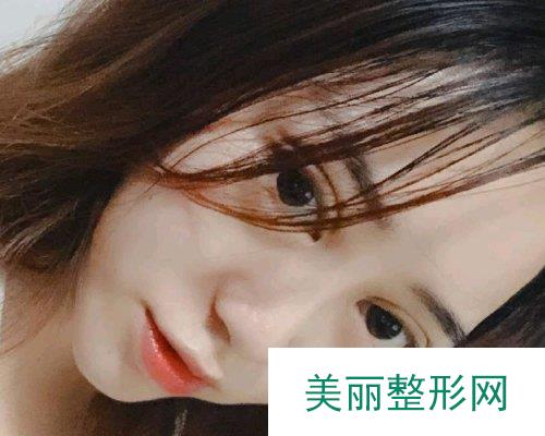 长沙美莱整形2019全新价格表详览及双眼皮恢复过程展示