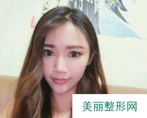 2019永州博美价格表心动一览及自体脂肪填充面部案例展示