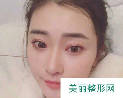 2019衡阳华美整形全新价格表一览及面部填充案例展示