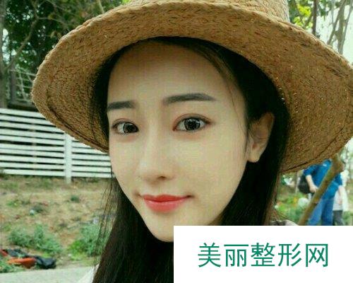 2019衡阳华美整形全新价格表一览及面部填充案例展示