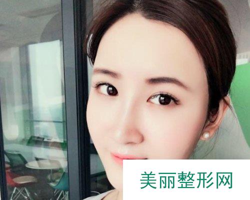 杭州格莱美整形医院2019价格表倾情分享及自体脂肪填充面部案例分享