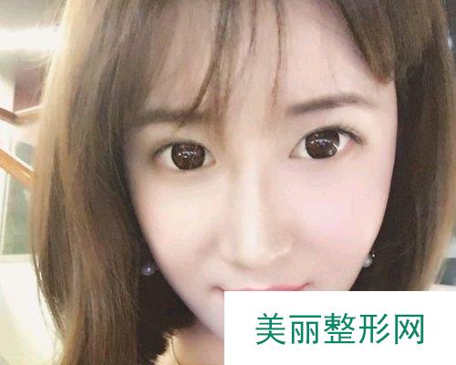 杭州格莱美整形医院2019价格表倾情分享及自体脂肪填充面部案例分享