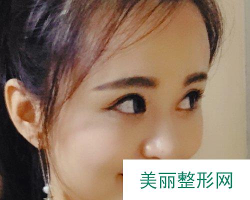 杭州美莱医院2019价格表详览及双眼皮果分享