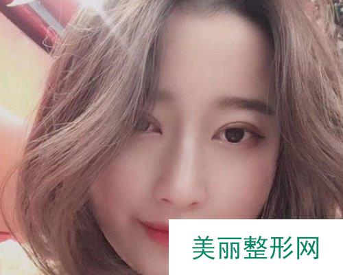 北京华韩医疗美容价格表，附双眼皮案例展示