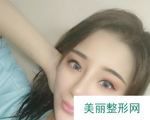 整形隆鼻怎么样？案例展示及2019价格表一览