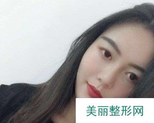 深圳美莱医院2019全新价格表一览及自体脂肪填充面部果分享