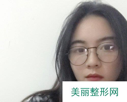 深圳美莱医院2019全新价格表一览及自体脂肪填充面部果分享