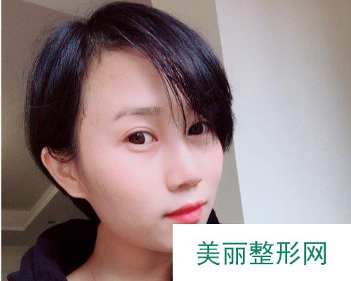 沈阳伊美尔整形2019价格表详情一览及鼻修复果对比