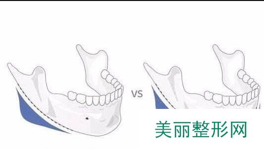 磨腮削骨