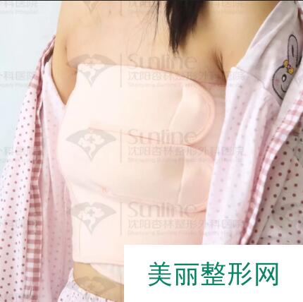 哺乳喂奶之后乳房下垂怎么办？刘建波假体隆胸立马安排！