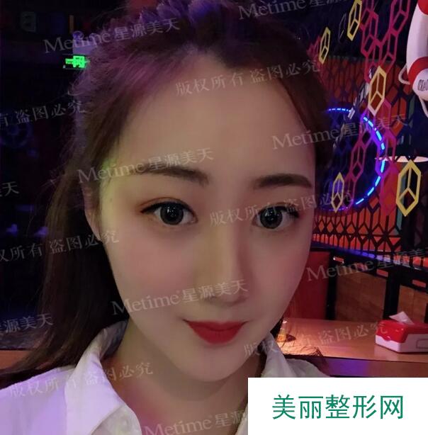 丰太阳穴邱立东在线咨询靠谱吗？少女自述蜕变经历~