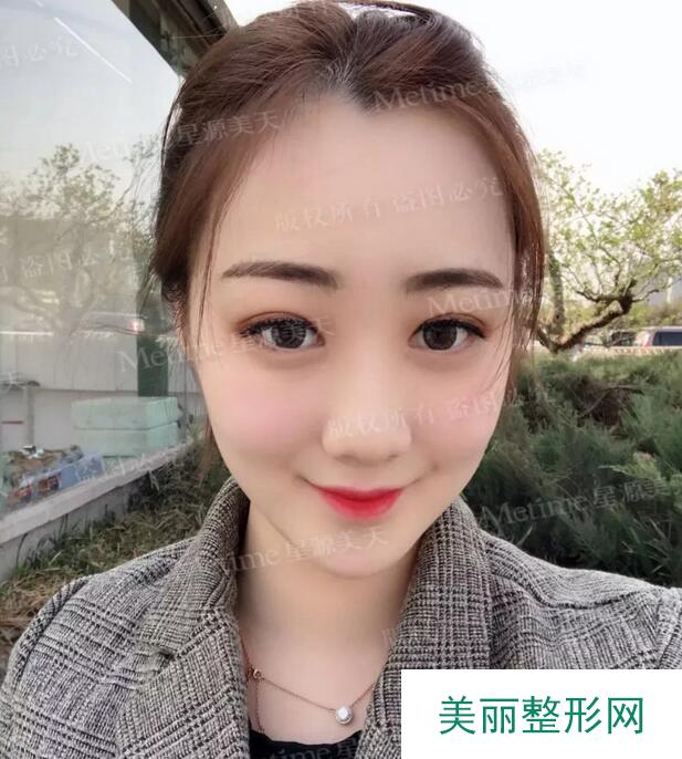 丰太阳穴邱立东在线咨询靠谱吗？少女自述蜕变经历~