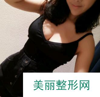 浙二医院整形美容科隆胸真实果曝光，自然柔软不影响哺乳