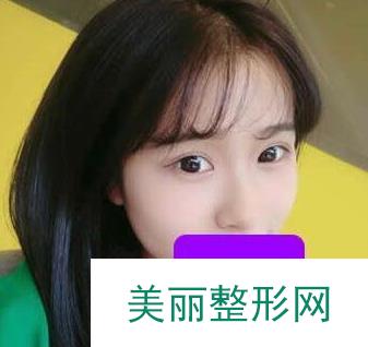 杭州第一人民医院整形科隆鼻怎么样？美丽小翘鼻非我莫属！