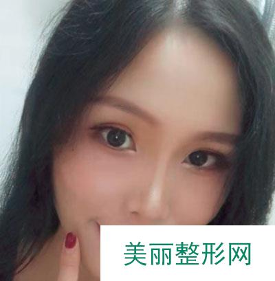 厦门华美医疗美容门诊部除皱瘦脸的案例