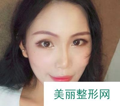 厦门华美医疗美容门诊部除皱瘦脸的案例