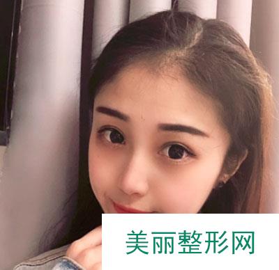 昆明美伊莱医疗美容鼻部多项案例