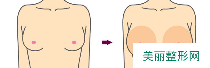 太原华美整形医院隆胸价格表
