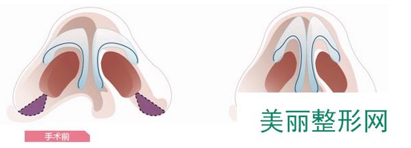 深圳阳光整形美容医院价格表真实曝光