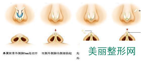 包头丽人整形医院项目价格表曝光