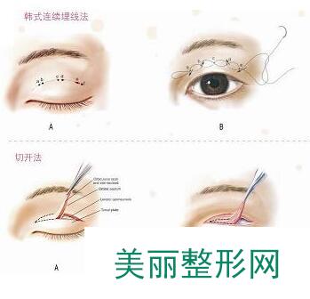 解放军105医院整形科价格表新一版暴光