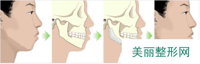 宿州美莱整形医院价格表惊艳预览