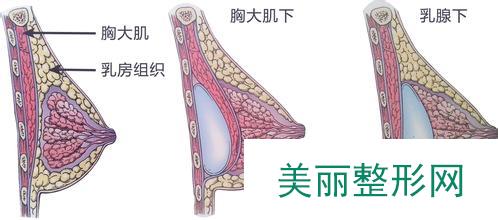 北京美莱医疗美容医院新版价格表新鲜曝光