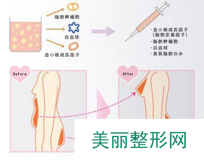 福州比华利美容医院价目表完整呈现