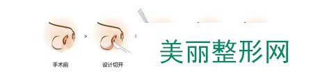 秦皇岛念奴娇医疗整形医院价格表2017全新价