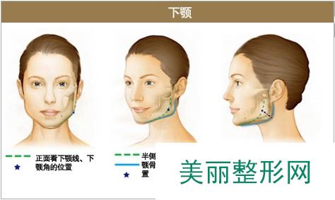 郑州七星整形医院价格表费用一览