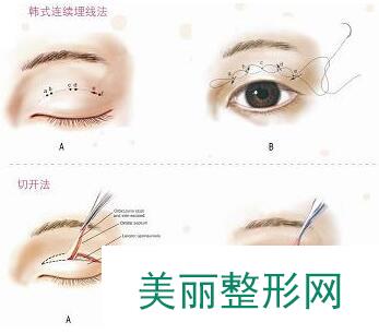 合肥刘大夫整形医院揭秘全新价格表揭秘