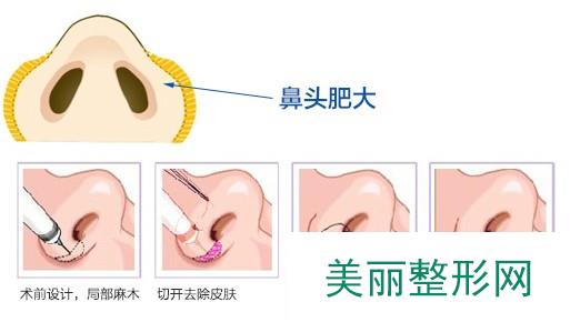 宁波协和整形医院价格表崭新曝光