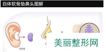 绵阳茗汇整形医院崭新价格表新鲜一览