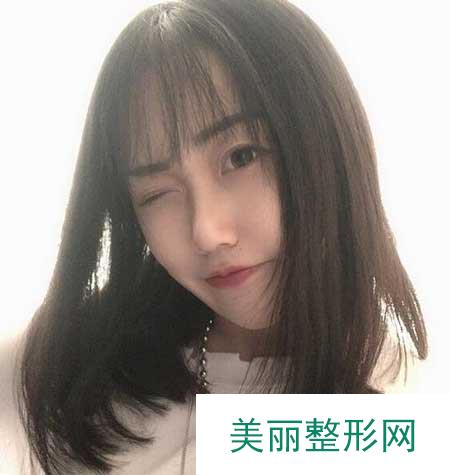 找上海华美徐文龙做完鼻子后，美极了，判若两人