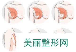 广东省人民医院整形科(价格表)参考推荐一览