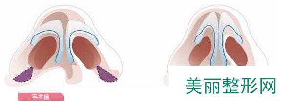 西安航天总医院整形科价目表全部一览推荐