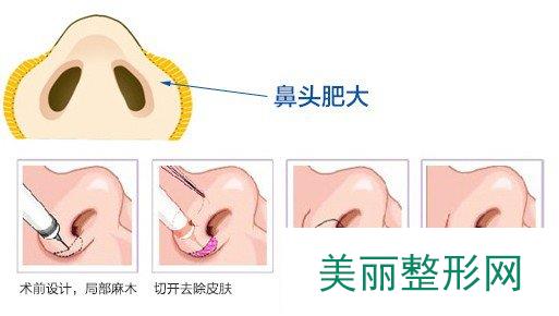 宜春华美整形医院价格表正规推荐一览