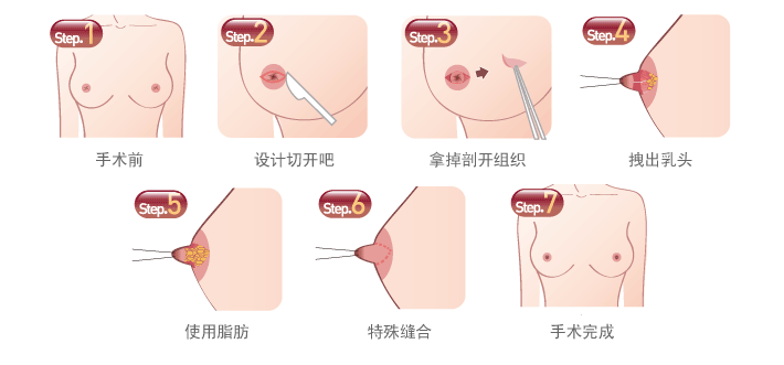 南京，乳房，整形，多少钱