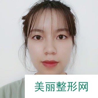 中部战区总医院整形科徐凯医生简介，双眼皮案例PLMM新反馈