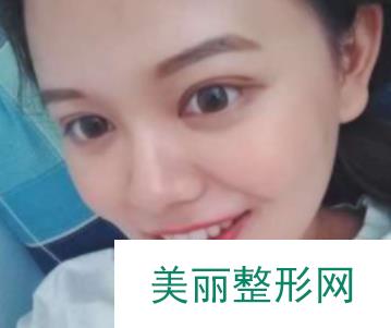 河北省中医院整形美容科怎么样？医生团队+特色项目+案例图~