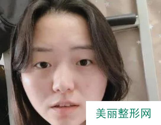 [术前功课]西京医院整形科技术怎么样？看我的案例反馈！