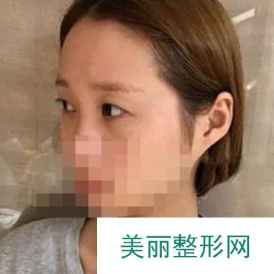 [评价]北京大学第三医院整形外科怎么样？附医生名单+案例~