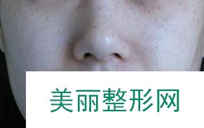 徐州三院美容科去疤痕怎么样？盘点那些年的成功案例~