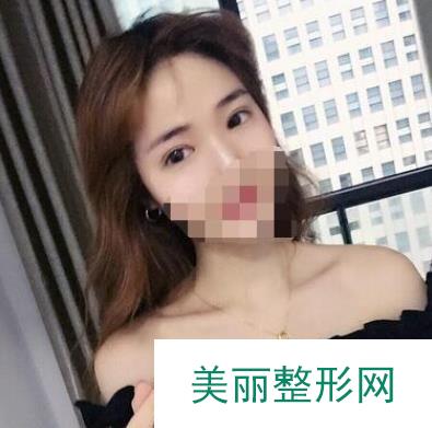 中山大学附属第三医院整形科怎么样？在线获取整形案例和医生名单~