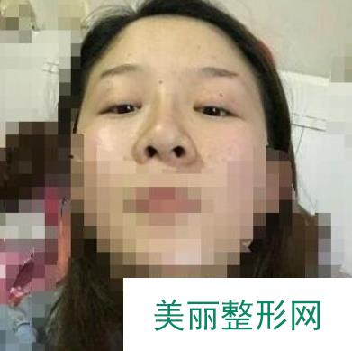 广西医科大一附院整形美容医院怎么样？附全新价格表一览~